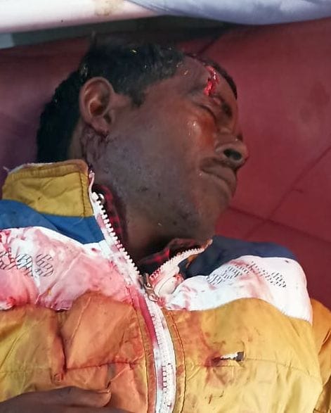 three injured in tiger attack