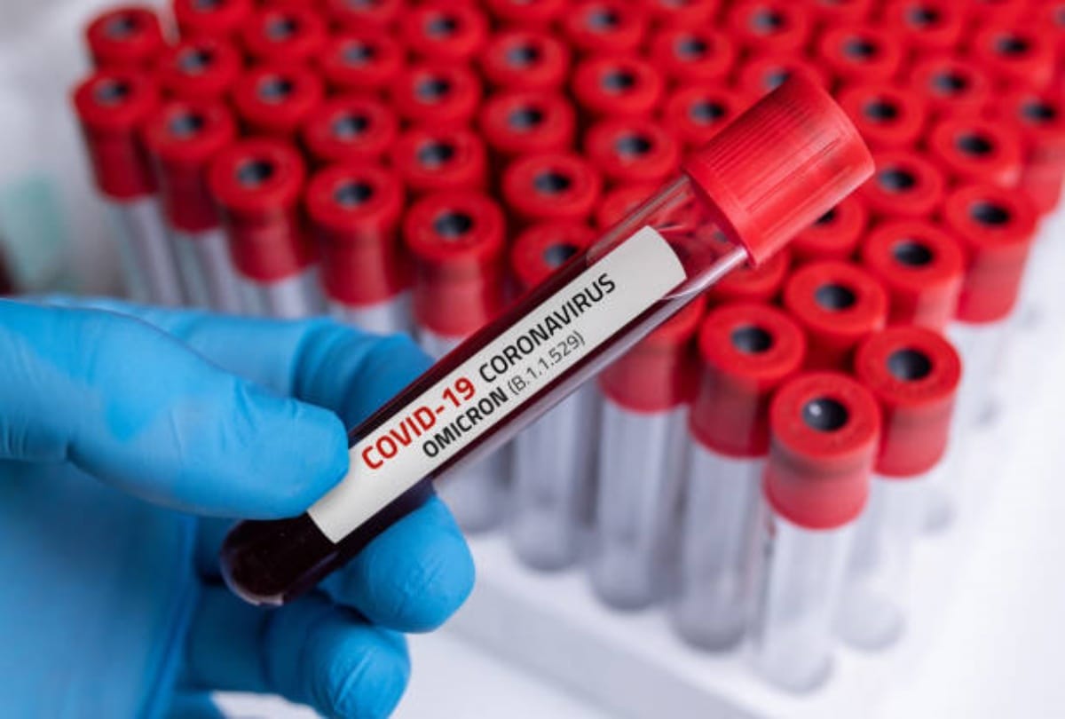 What is CT Value Of Covid Omicron Variant, CT Value Range, CT Value Kitni Honi Chahiye in Hindi