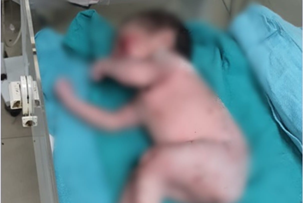 Humanity shamed in Indore: Newborn girl was thrown into the bushes wearing a necklace... the police rushed to the hospital