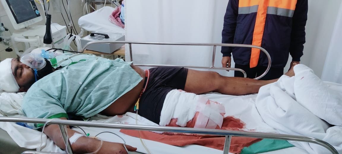 Bike rider's leg was chopped off in an accident on Jewar-Khurja road
