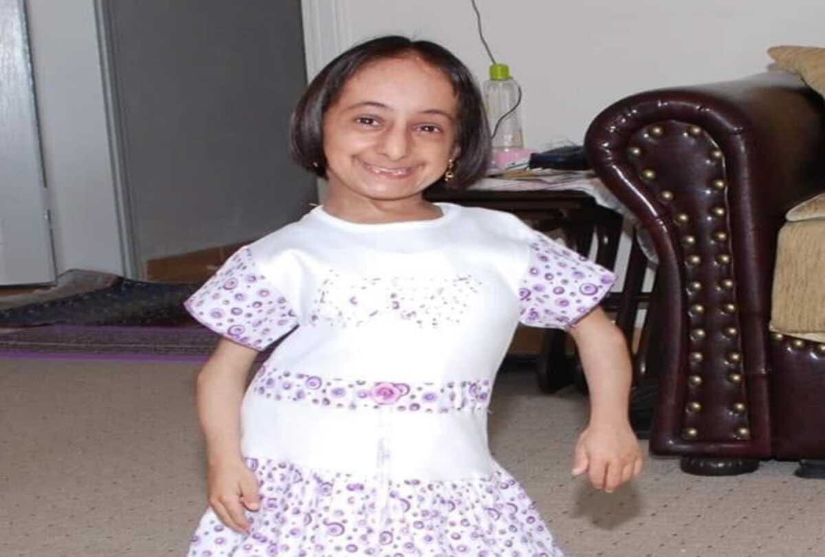 viral story world shortest woman elif kocaman passed away at age of 33