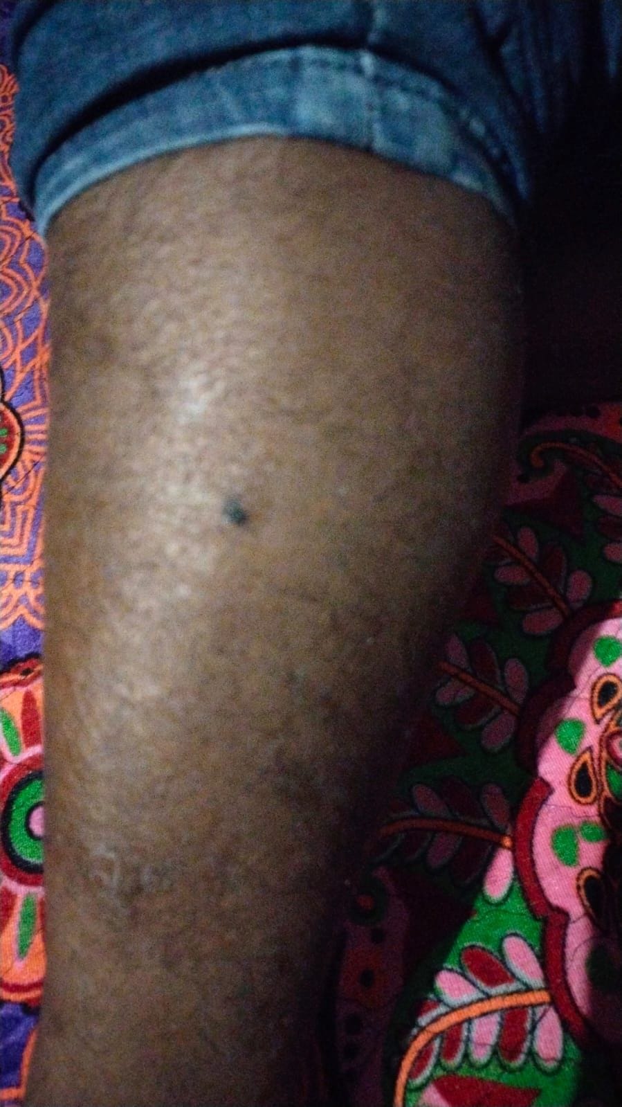30 thousand rupees looted by attacking the youth with a knife