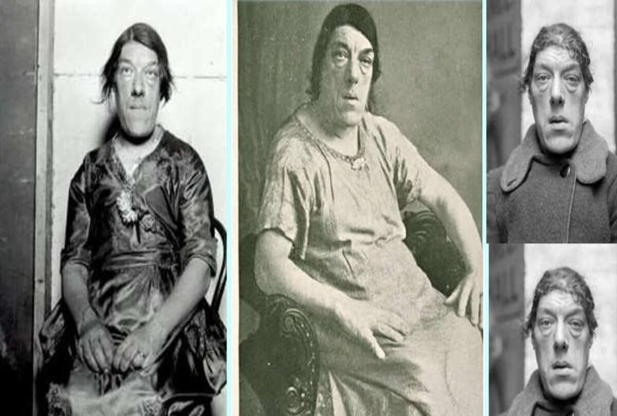 worlds ugliest woman mary england know the shocking things about her