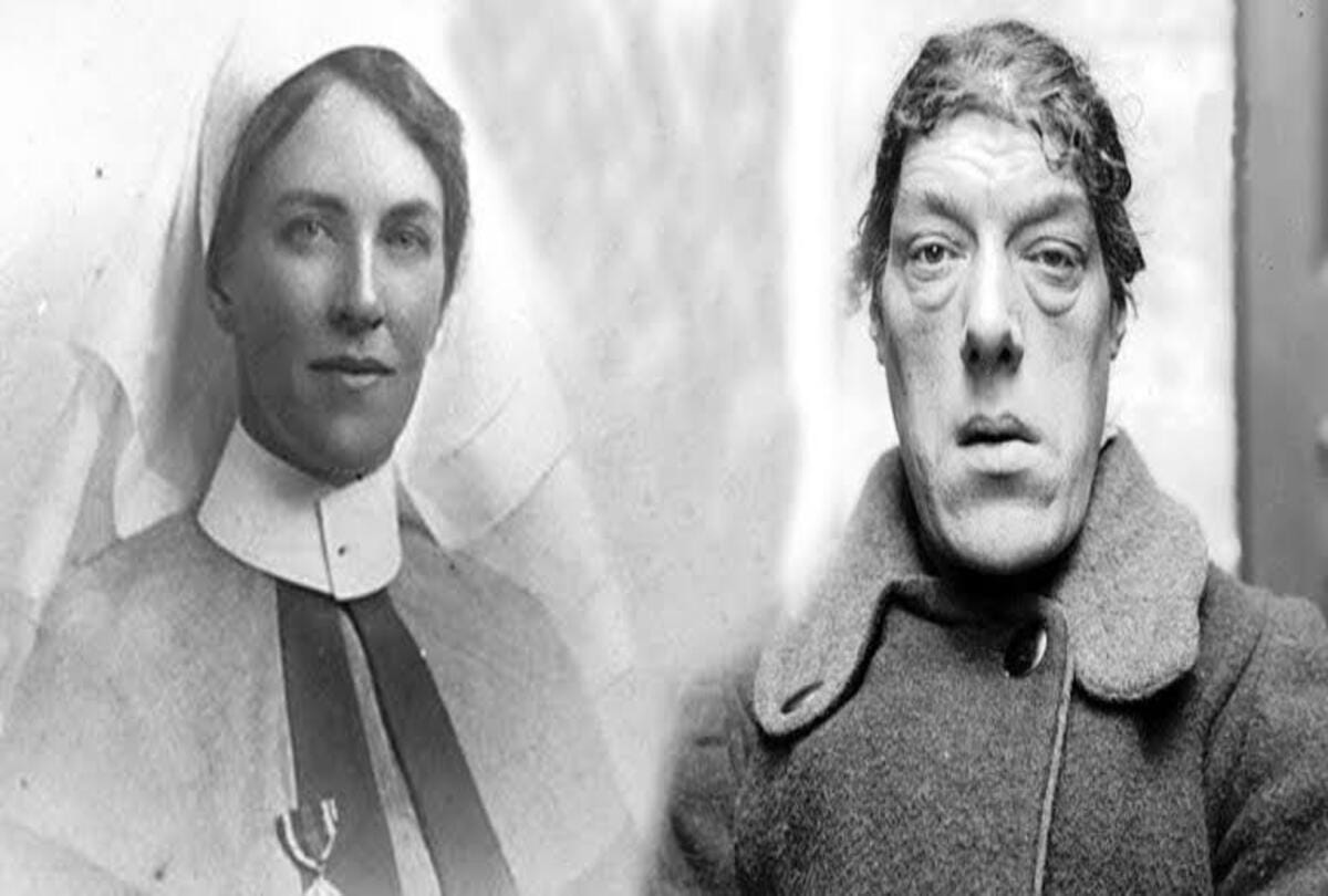 worlds ugliest woman mary england know the shocking things about her