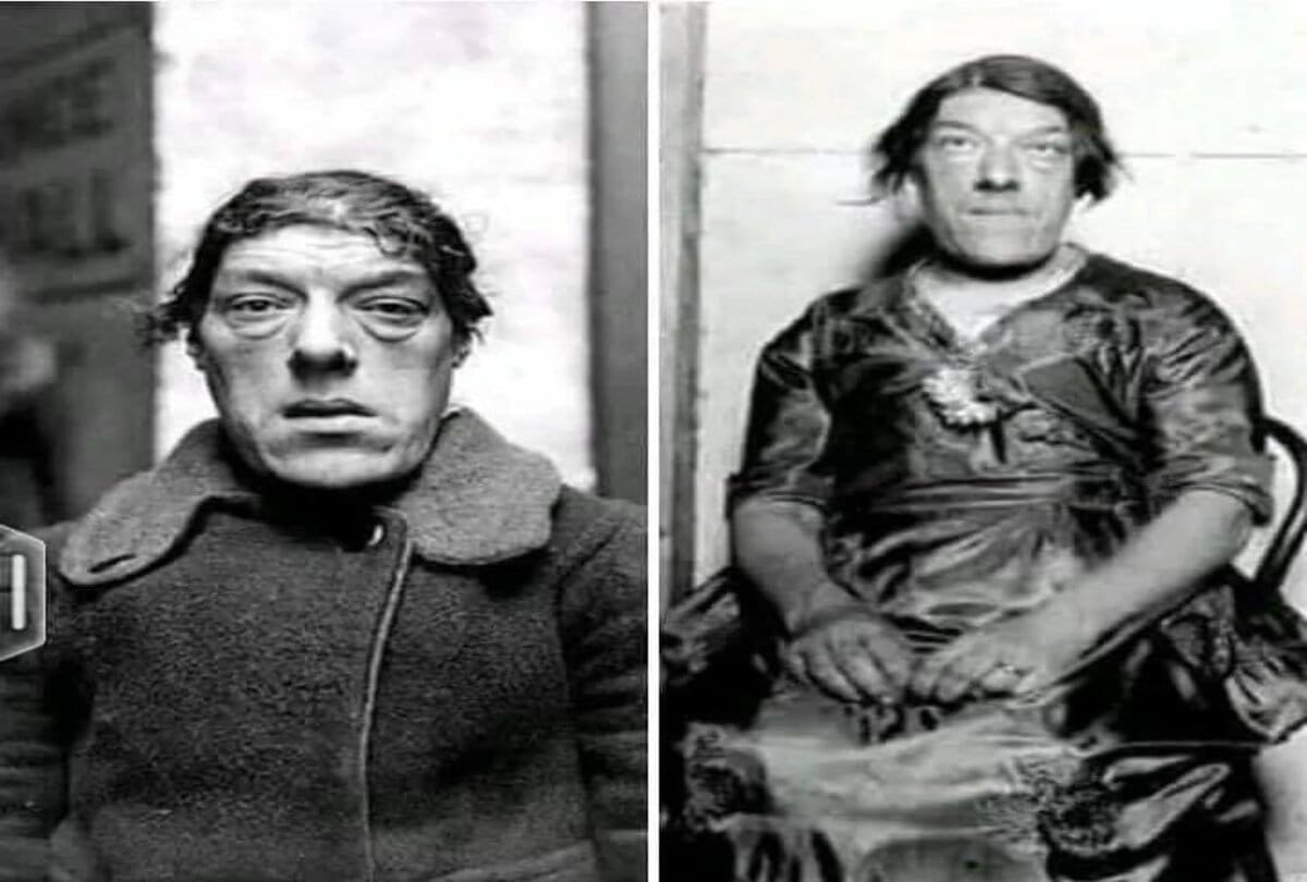 worlds ugliest woman mary england know the shocking things about her