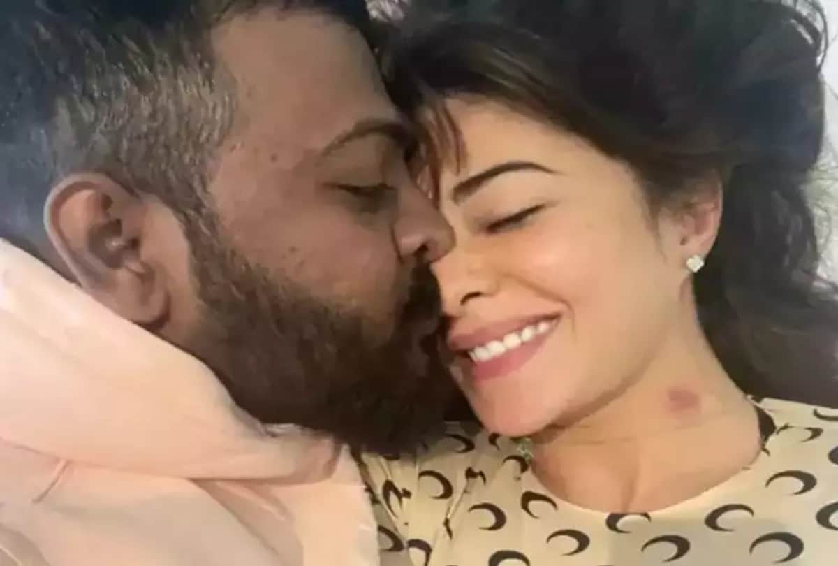 Money laundering: Another picture of Jacqueline Fernandez with Sukesh Chandrashekhar goes viral love bite shown on the neck of the actress