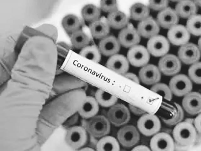 Two professors and three students infected in PG College Agastyamuni