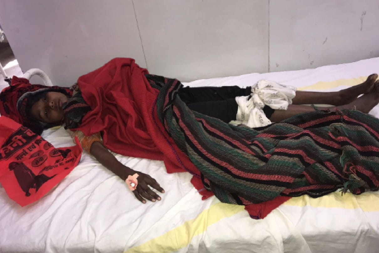 Chhatarpur: 9-year-old girl was bitten by a 10-feet long snake, the girl admitted to the district hospital in critical condition