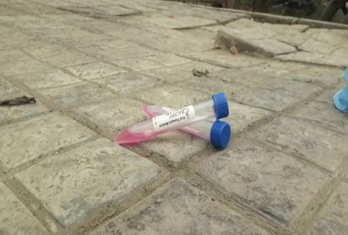 Samples of suspected corona patients found outside the Covid RTPCR Test center in Agra
