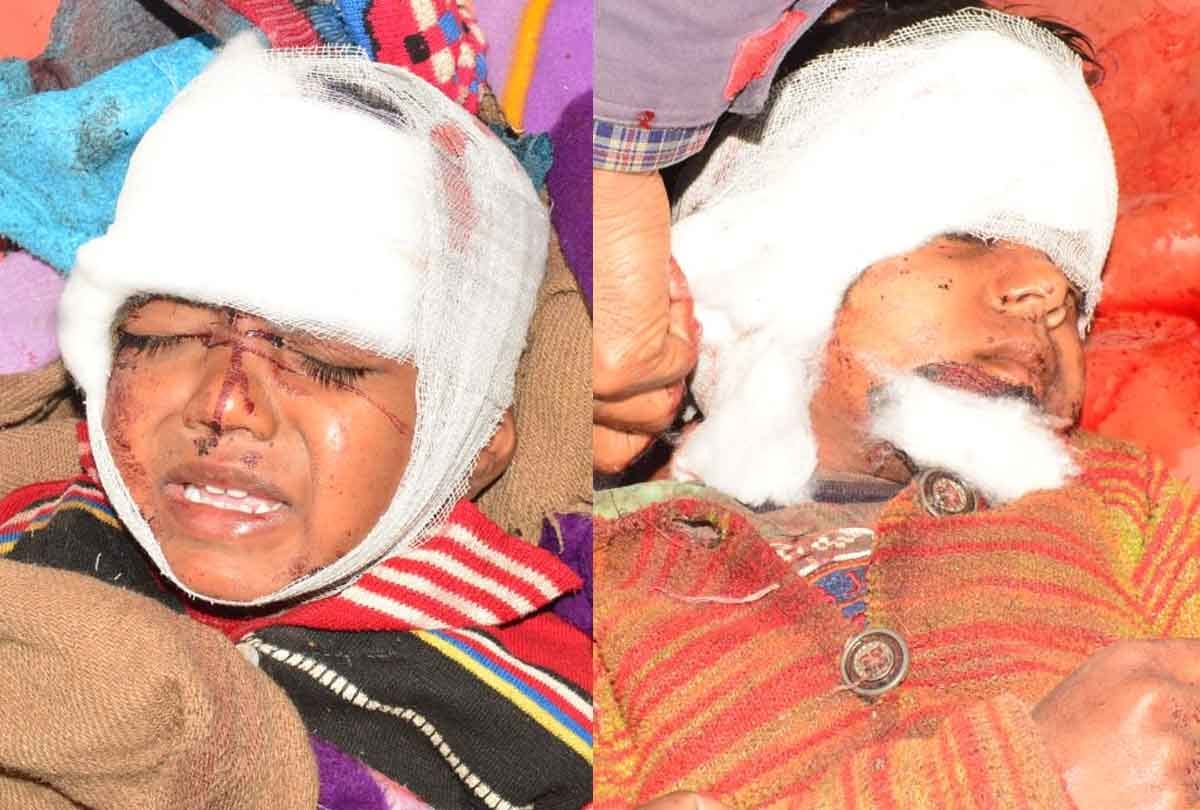 Innocent girl cried then hit the whole family: young man injures himself by attacking wife, daughter and son