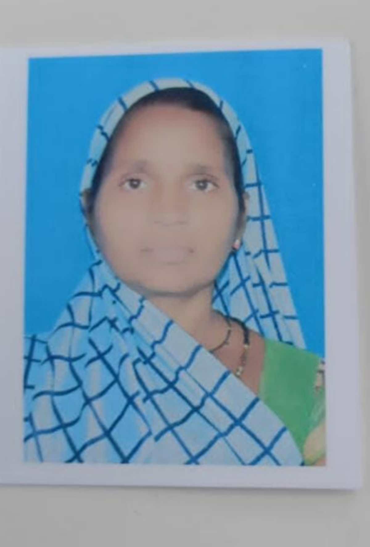 Horrible incident with woman in jaunpur acid attack when filed after brok woman leg