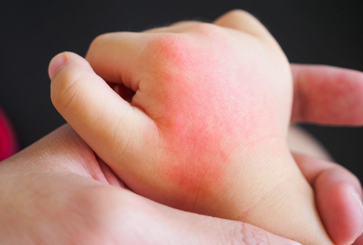 Health Tips Home Remedies for Swollen Fingers Winter Care Tips in Hindi