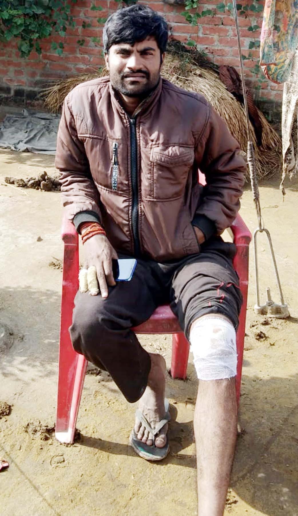 Leopard attack on farmer who went to guard the field