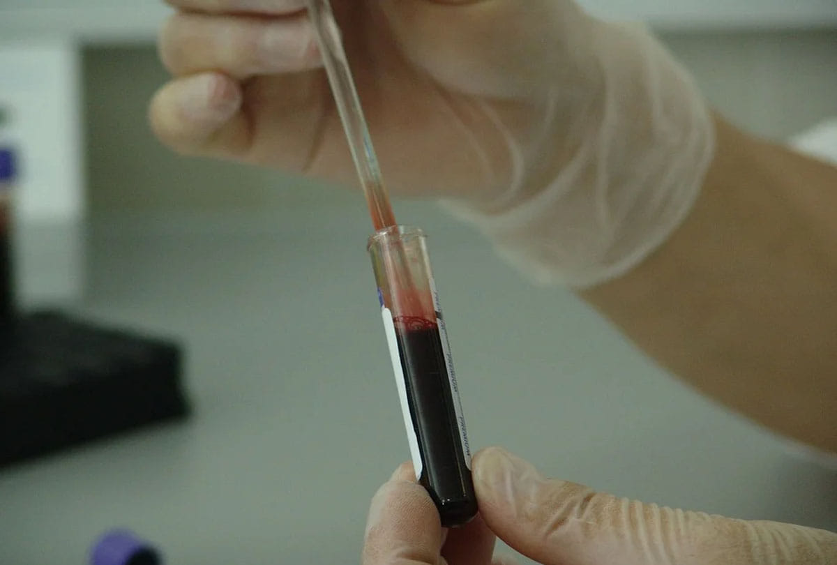this blood is very special and rare know what is the golden blood