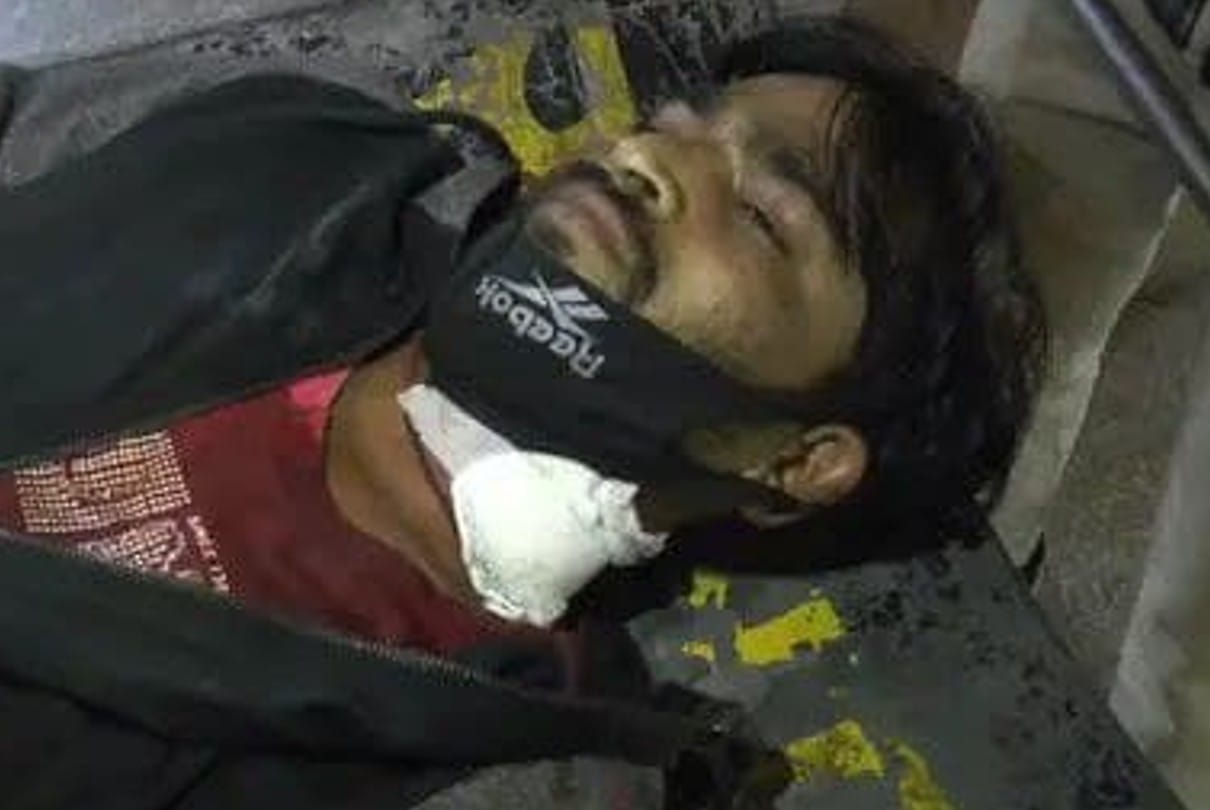 Indore: A young man caught in the grip of Chinese manjha, blood shed due to throat slit ... got admitted in the hospital