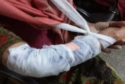 दादी को पोते ने कुत्ते से कटवाया