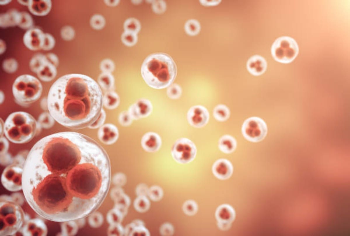 high blood pressure, low hemoglobin in hilaya people