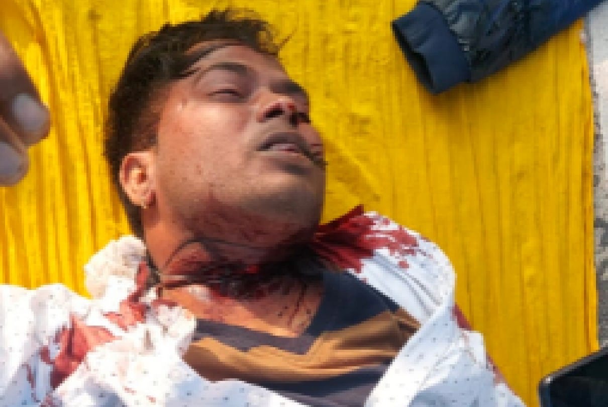 Chhatarpur: Bloody body of youth found in luxury car on fourlane near Gathewara village, fear of murder