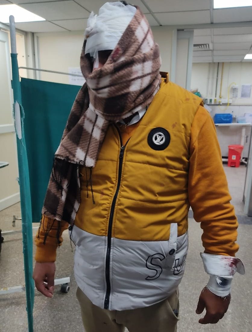 financier in kutcha camp, lender's family clashed, eight injured