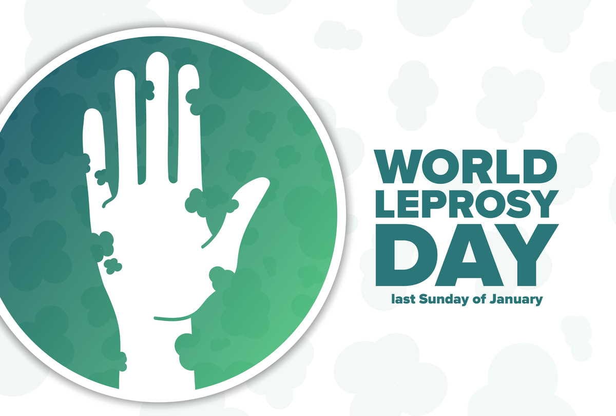 World Leprosy Day, leprosy causes symptoms and treatment