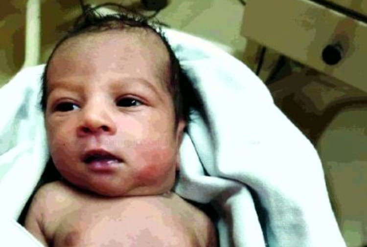 The hard work of doctors saved the life of a girl child in Bhiwani of Haryana