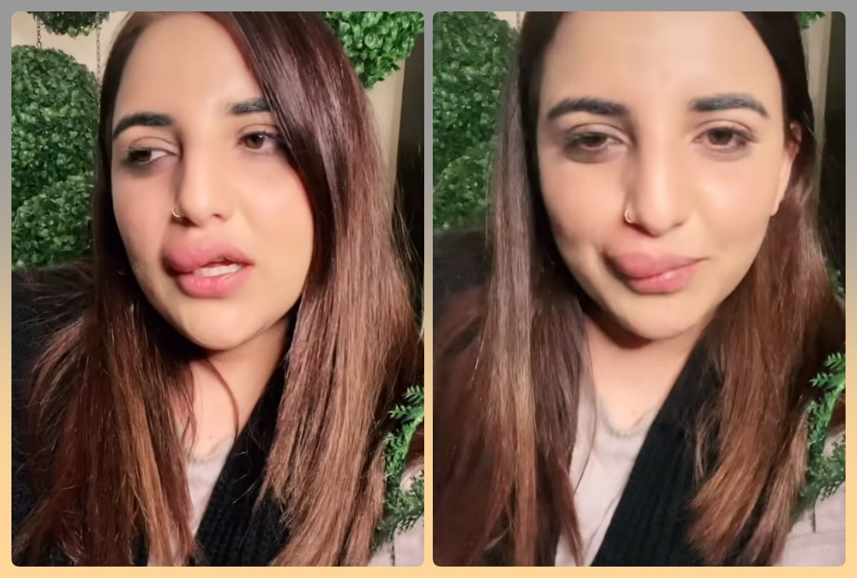 Pakistani TikTok star lip job half-done says she has no money