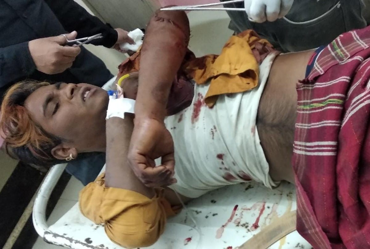 Sehore: Youth seriously injured in leopard attack, treatment continues in district hospital