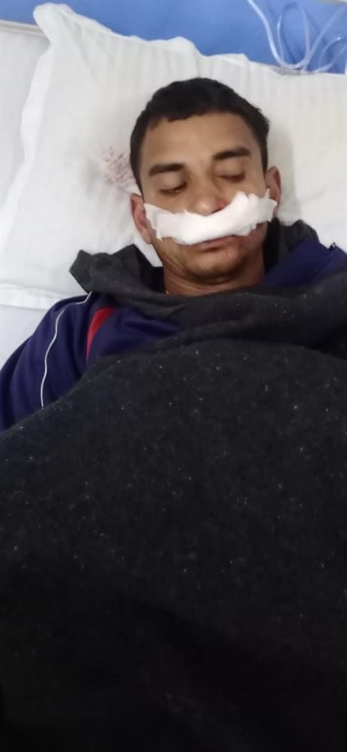 Hathras: A young man returning after running was hit by a bike, injured