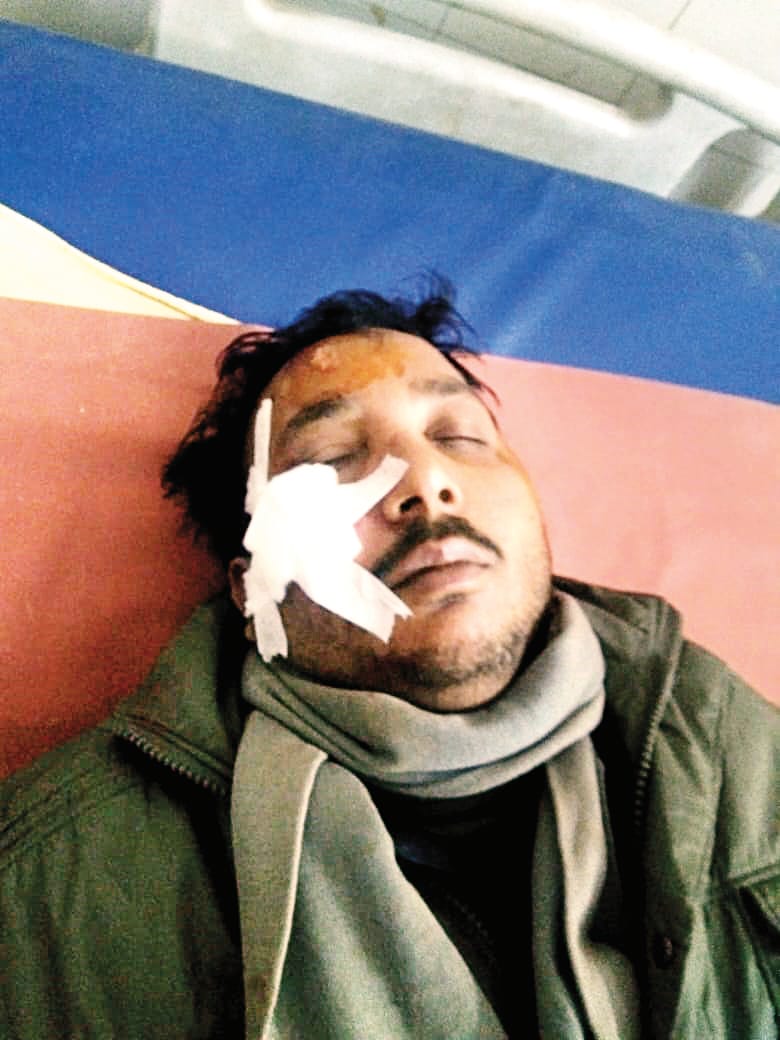 Dispute in Partapur Chaudhary, flour mill owner and son bled