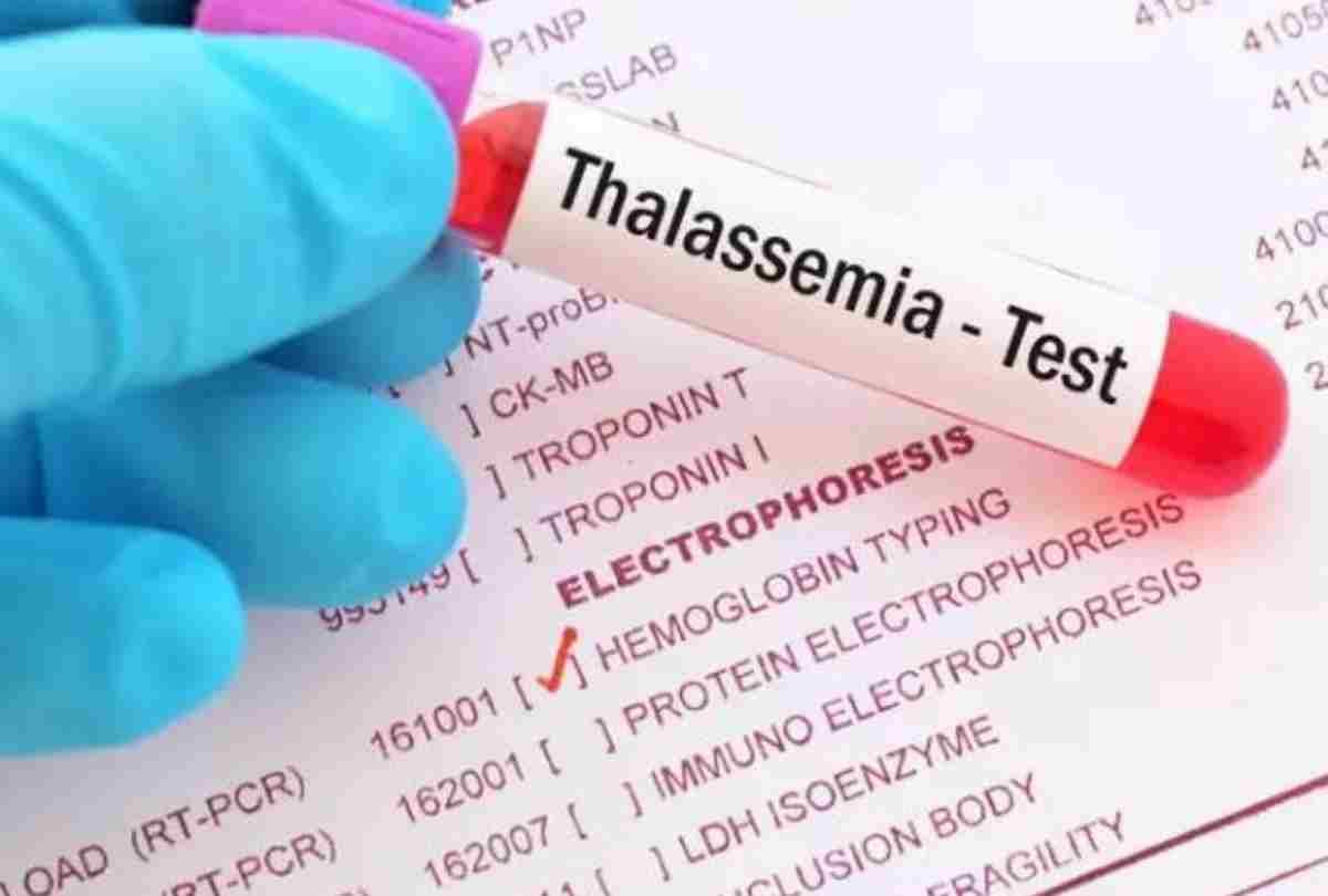 Rajasthan Health Department started my Certificate-my honor Campaign for thalassemia patients