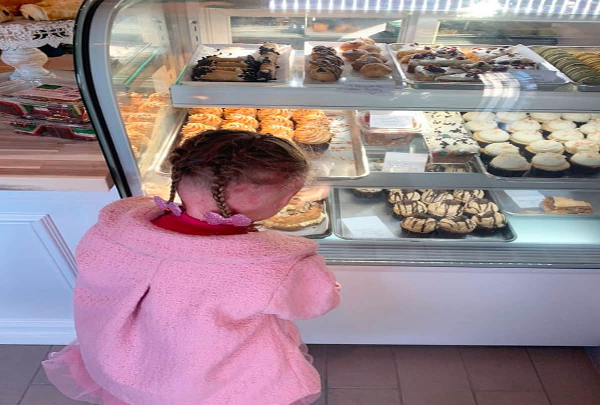 baby girl suffering from harlequin ichthyosis why 4 year old girl taking 2100 calories a day like a young man