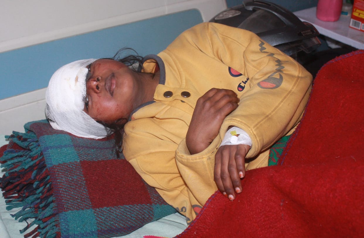 Leopard attacked sleeping villagers in two villages of Dilari, seven injured including three innocent