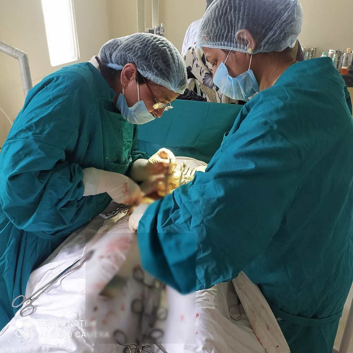 4 kg tumor found in a womans stomach