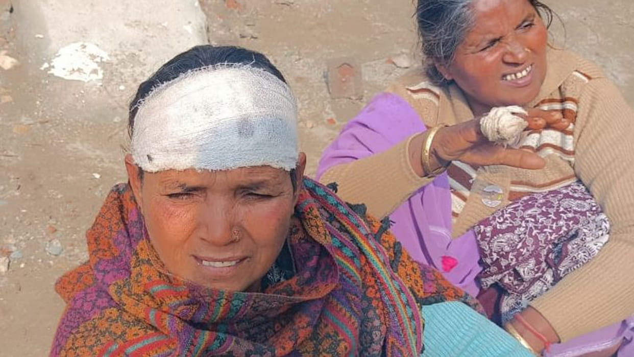 Fighting fiercely between two sides in old enmity five including woman injured police engaged in investigation