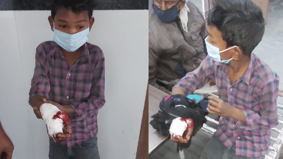 A 10-year-old boy put his hand in a fodder cutting machine in Chhatarpur, cut off 3 fingers
