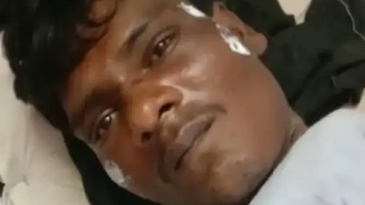 Taliban punishment in Guna: On suspicion of theft, a Dalit youth was naked and hit with burning wood, one accused arrested