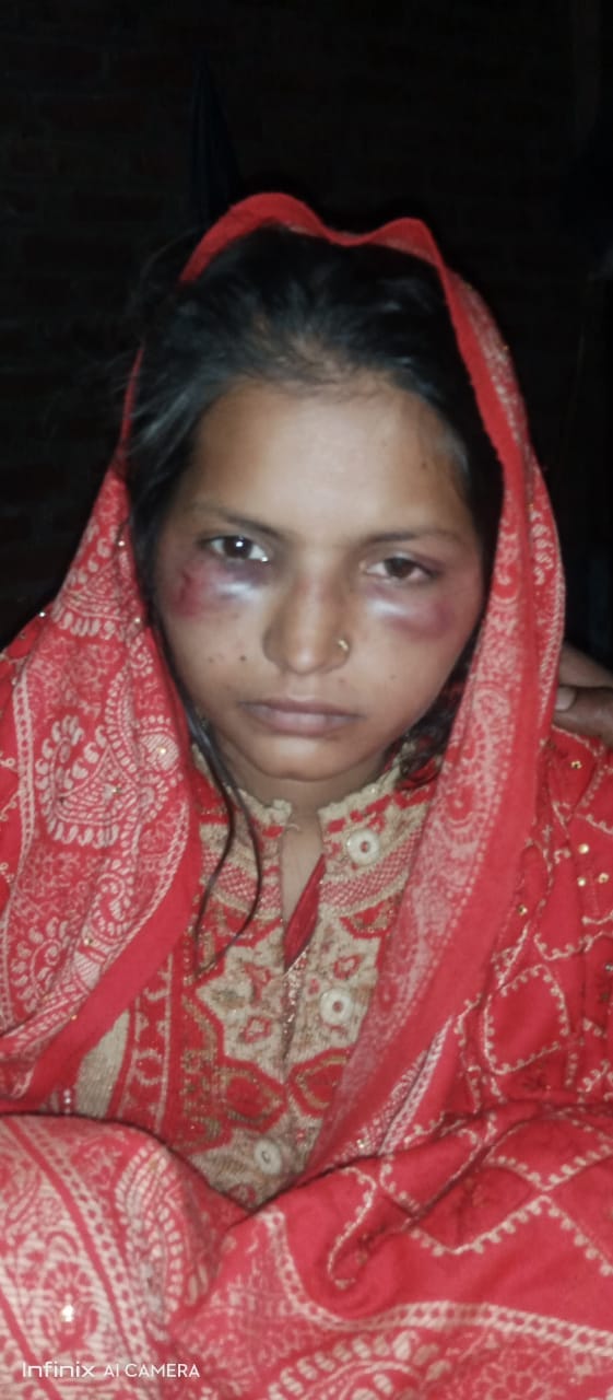 hardoi news,Newlyweds were beaten up and thrown out of the house