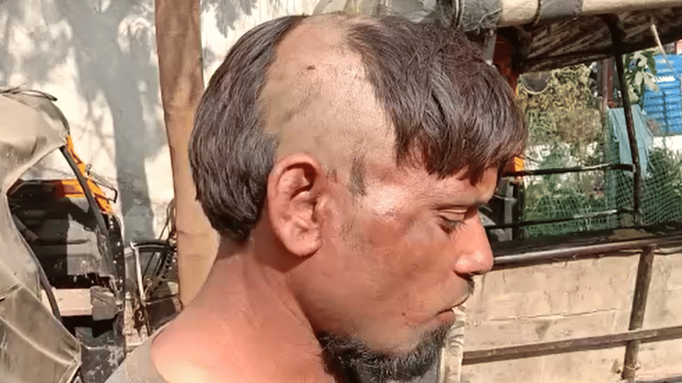 Unique punishment for thief: Villagers cut off half of their head on suspicion of animal theft in Damoh, handed over the accused to police