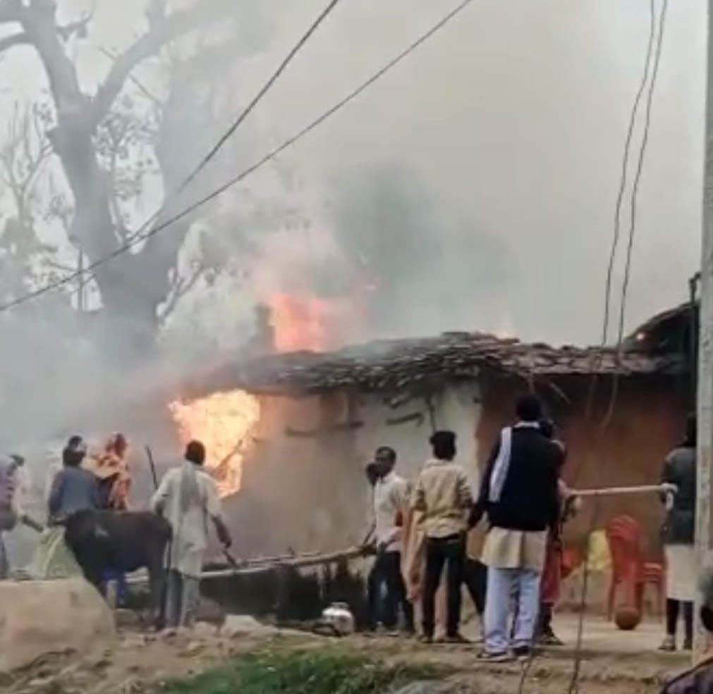 80 thousand rupees and jewelery burnt due to fire, youth scorched