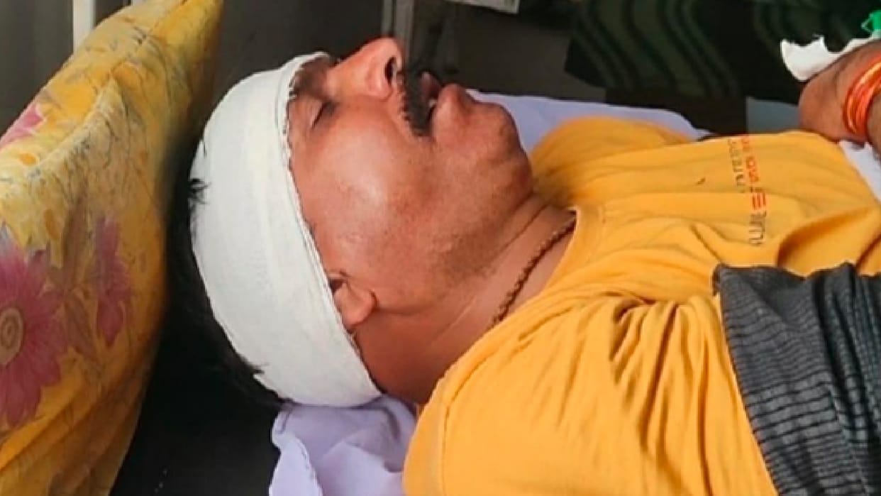 World Head Injury Awareness Day today: Do not take head injury lightly, it can cause heavy damage