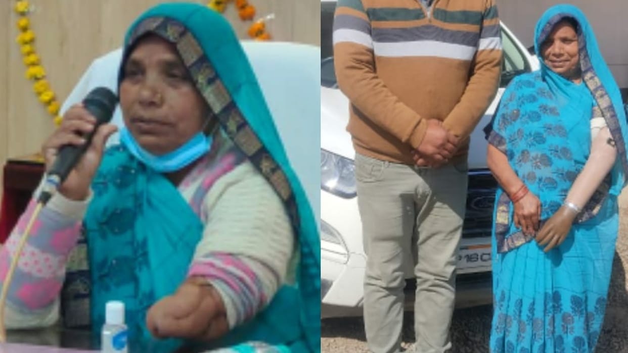 Chhatarpur: On the initiative of Chief Minister Shivraj Singh Chouhan, a disabled woman got an artificial hand