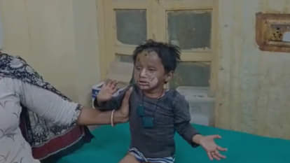 घायल तीन साल का बच्चा।