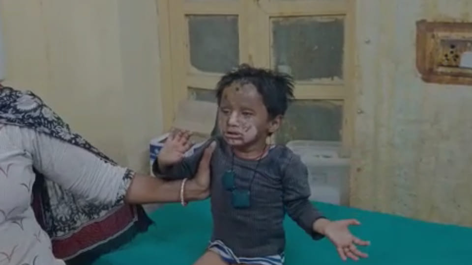 Rajasthan news Explosion occurred while refilling gas in car child injured in pali
