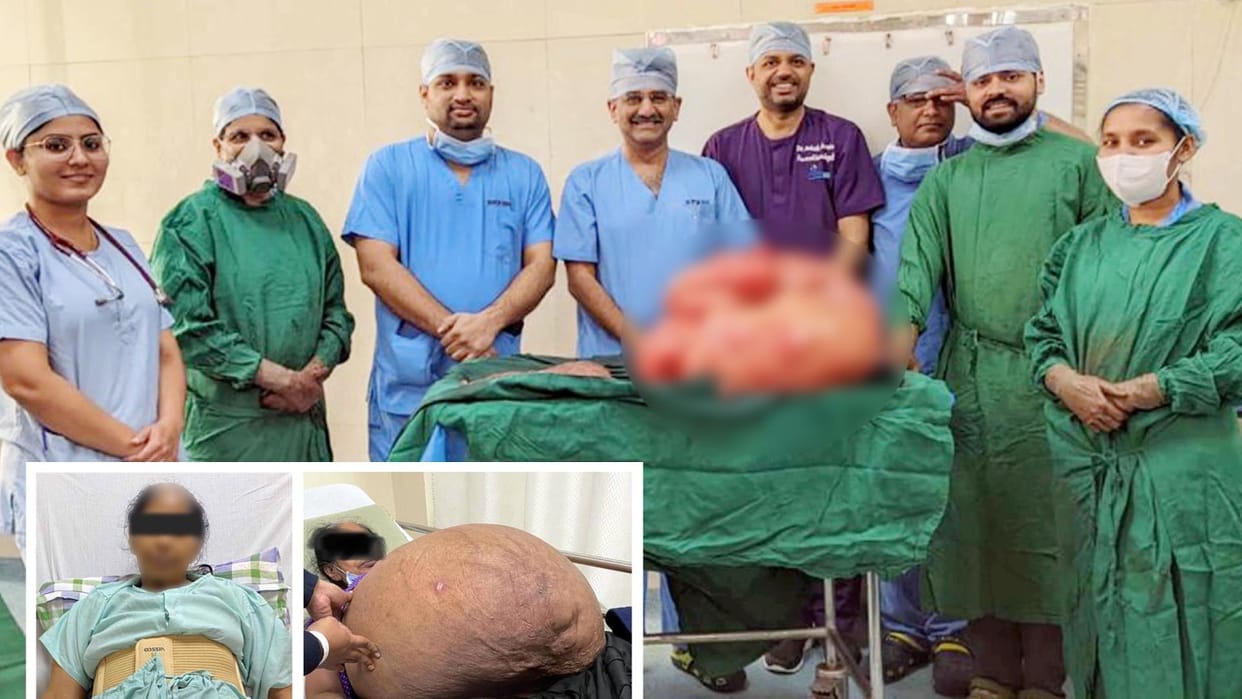 Ahmedabad Woman shrinks to 49kg after losing 47kg tumor