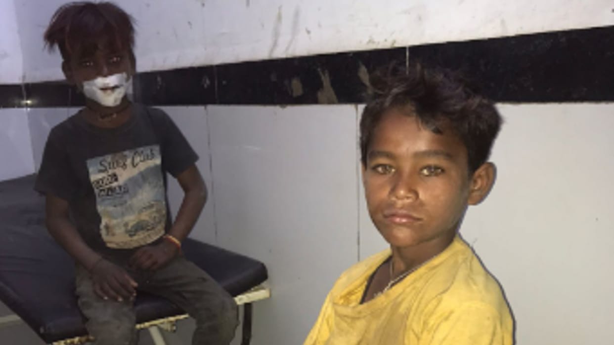 Chhatarpur: Children begging on the road, victims of accident, seriously injured admitted to district hospital