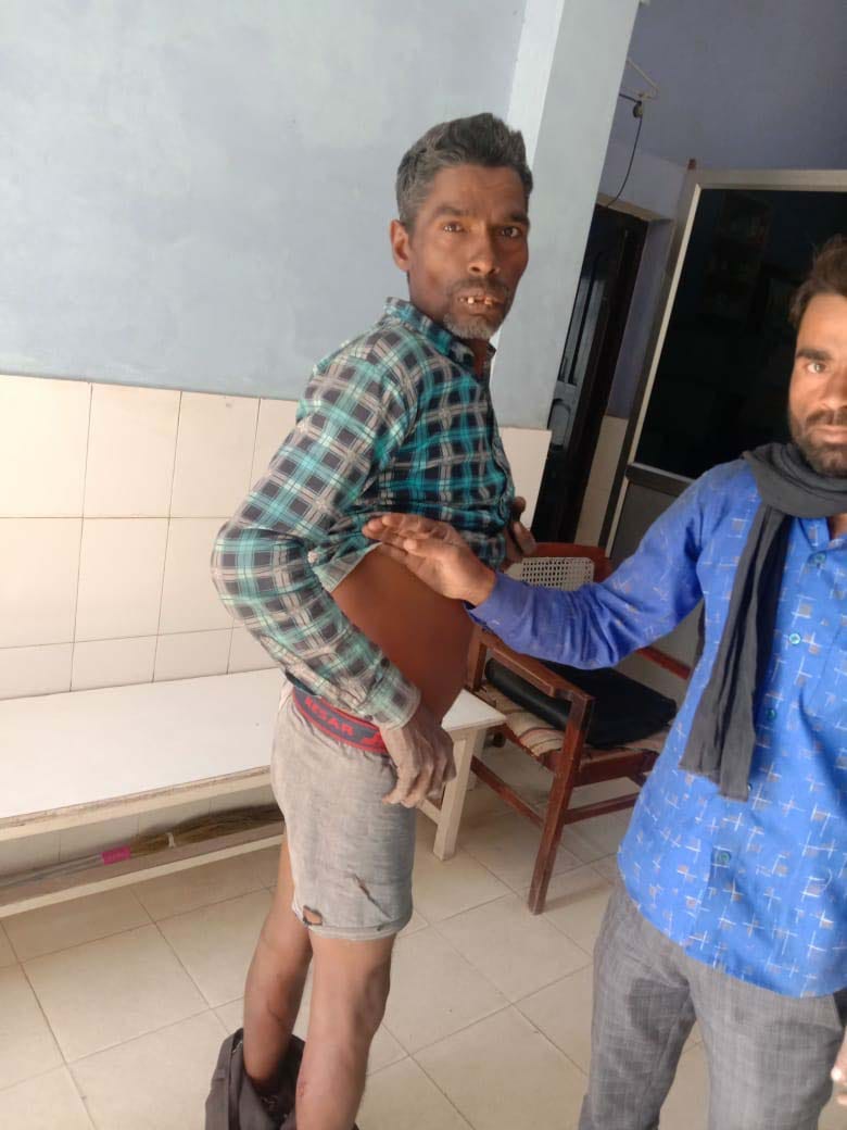 Tiger attack on youth harvesting sugarcane, injured
