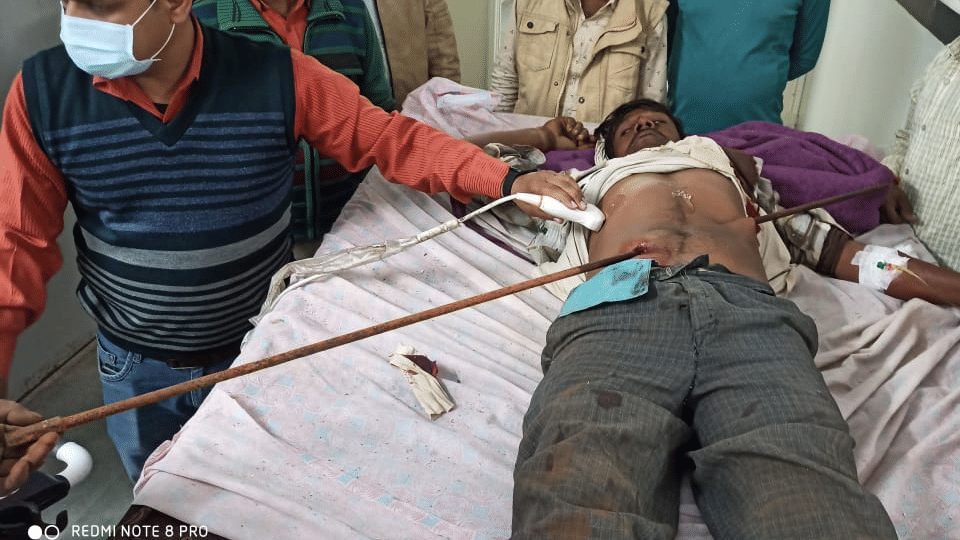 Chhatarpur: While building a house 5-feet iron rod injured a labourer, Doctors performed a surgery to remove it