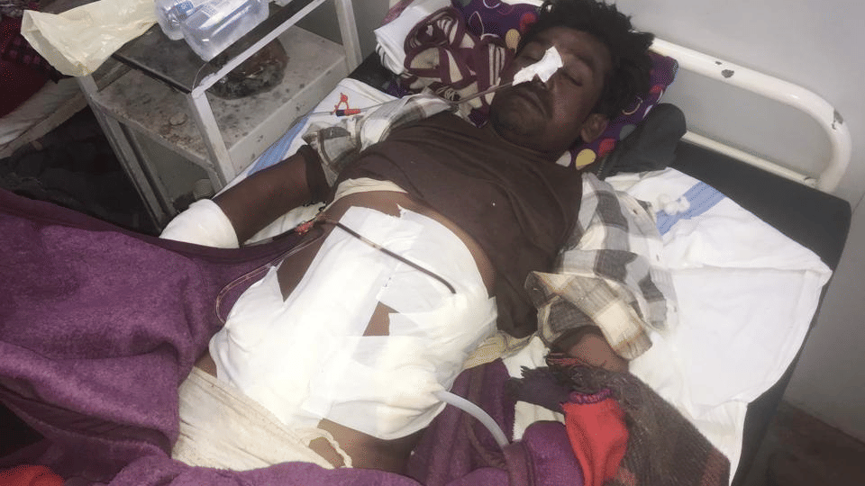 Chhatarpur: While building a house 5-feet iron rod injured a labourer, Doctors performed a surgery to remove it