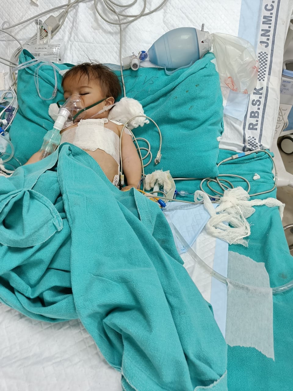One year old innocent got open heart surgery done by RBSK