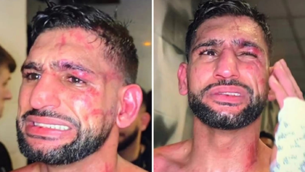 Amir Khan Beaten Badly by Kell Brook: Two time World Champion Amir Khan Badly Bruised, says want to retire